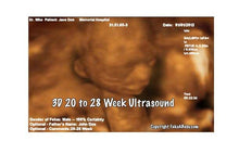 3D 20 to 28 week ultrasound