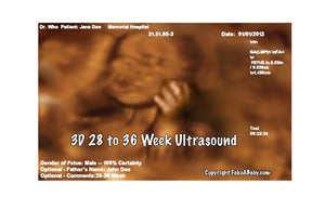 3D 28 to 36 Weeks Ultrasound