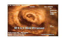 3D 4 to 6 week ultrasound