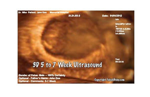 3D 5 to 7 week ultrasound