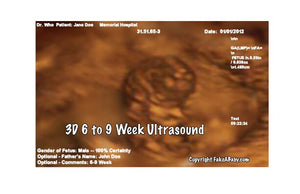3D 6-9 Weeks Ultrasound