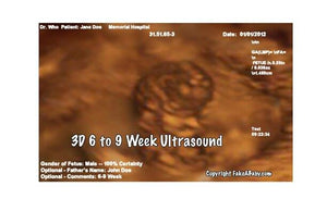 3D 6 to 9 week ultrasound