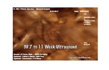 3D 7-11 Weeks Ultrasound