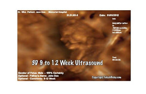 3D 9 to 12 week ultrasound