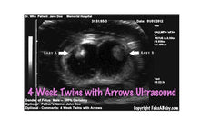 4 week twins with arrows ultrasound
