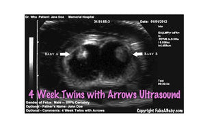 Fake Ultrasound 4 Week Twins with Arrows
