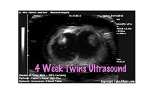 4 week twins ultrasound