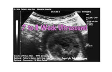 7 to 8 week ultrasound