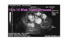 10 to 14 week triplets ultrasound