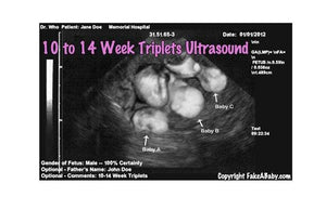 Fake Ultrasound 10 to 14 Week Triplets